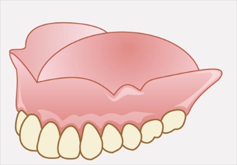 歯医者さんが教える！入れ歯における利点と欠点