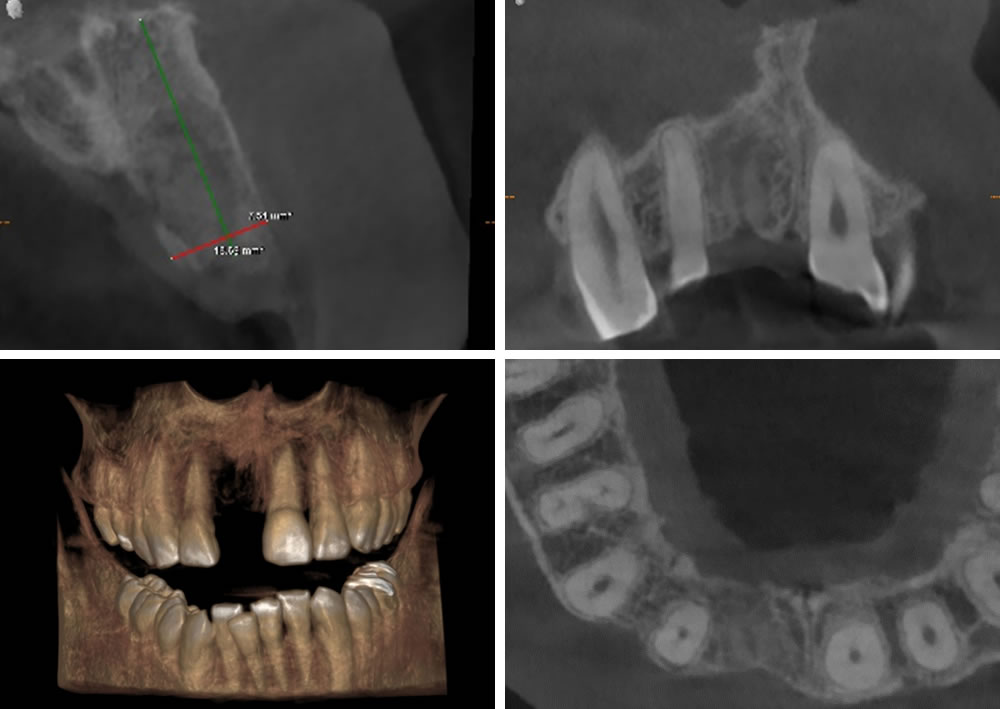 患者さんからよくある質問：CT撮影と歯の治療