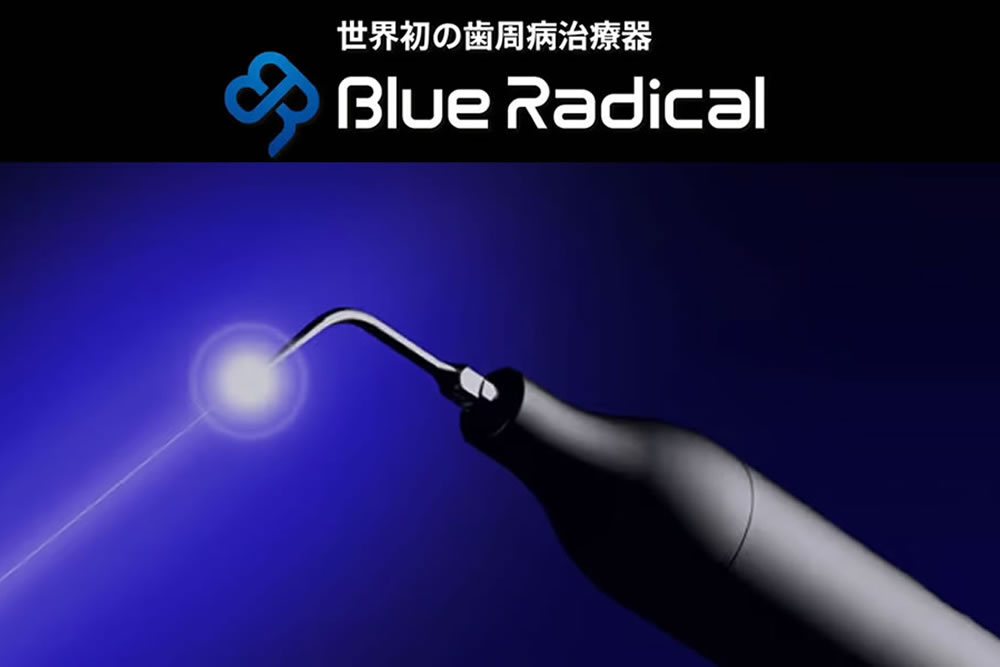 ブルーラジカル(非外科的歯周病治療)