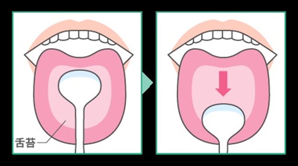 歯科衛生士が教える！口臭対策としての舌のケア
