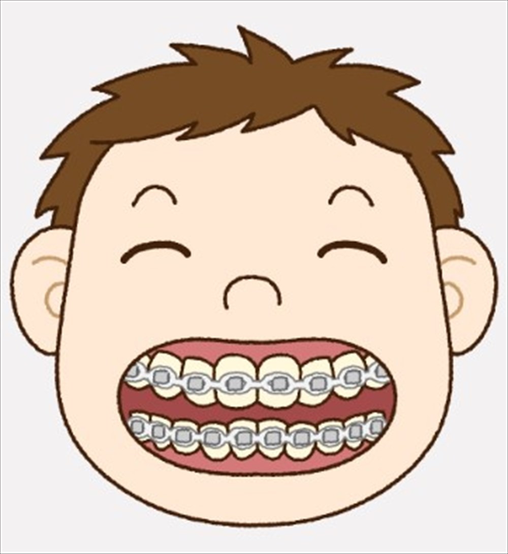 歯医者さん自身が体験した歯列矯正のお話⑤